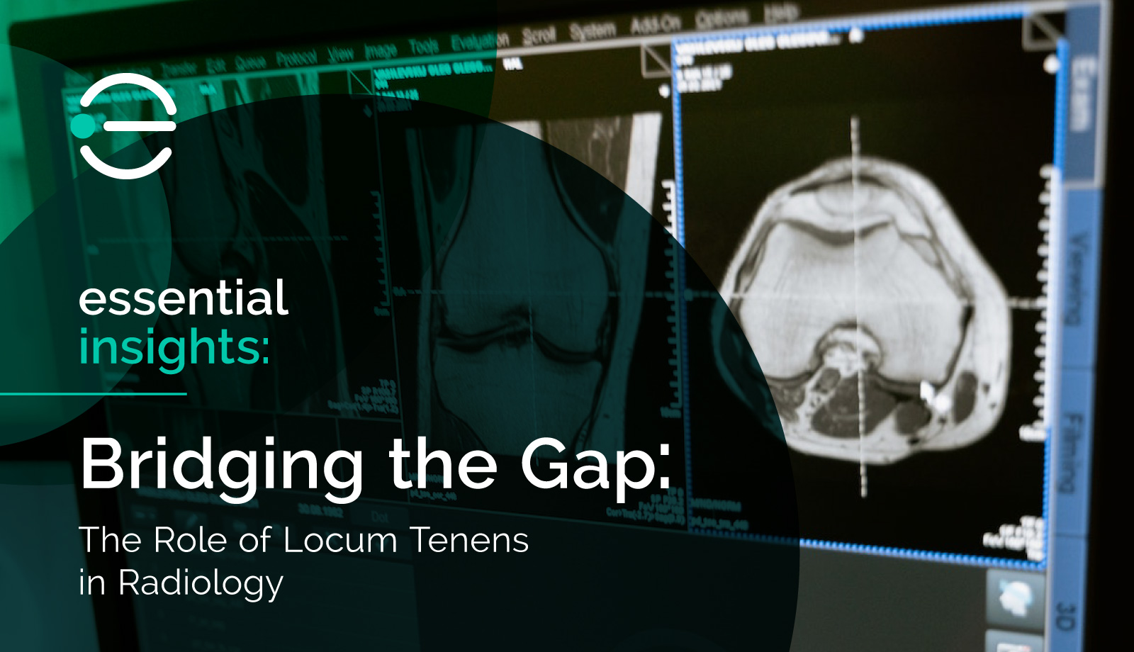 A blog graphic that features a radiograph image in the background and says Essential Insights: Bridging the Gap: The Role of locum tenens in radiology